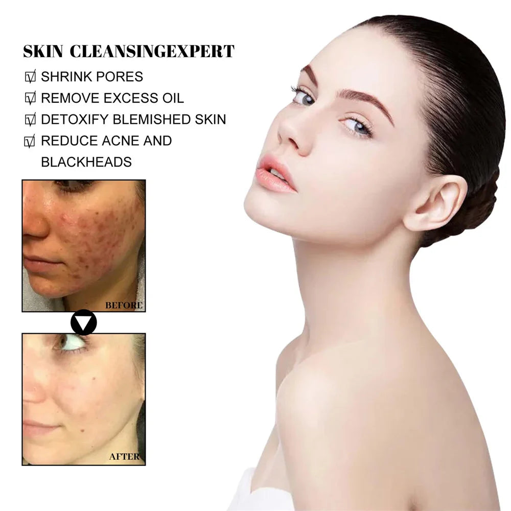 West Month Blackhead Removing Solid Mud Facial Mask