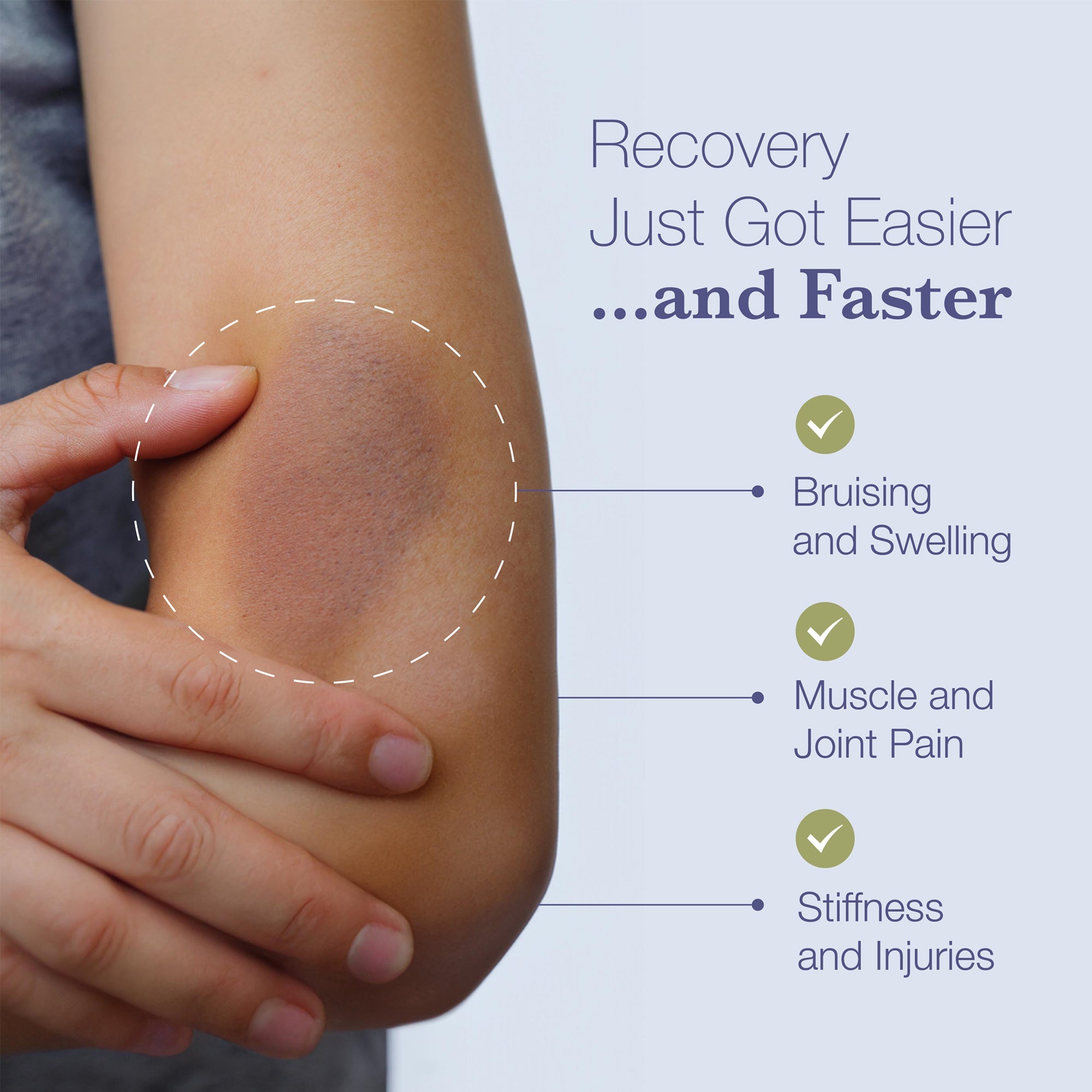 Arnica Bromelain Capsules for Bruise Support