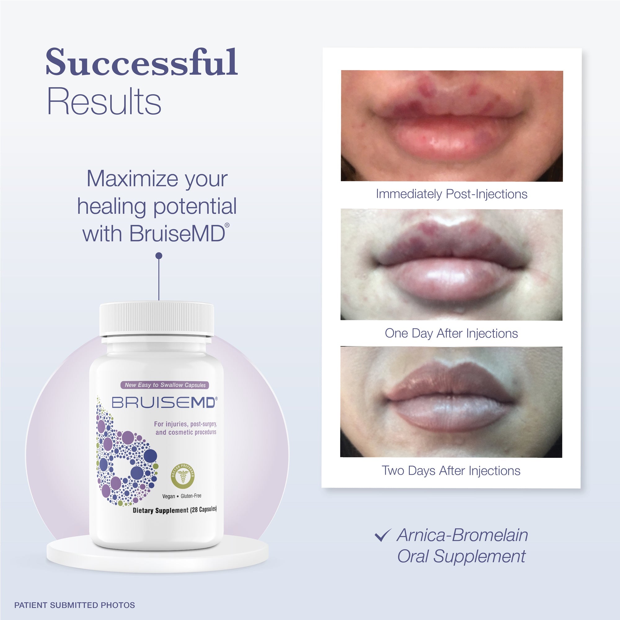 Arnica Bromelain Capsules for Bruise Support